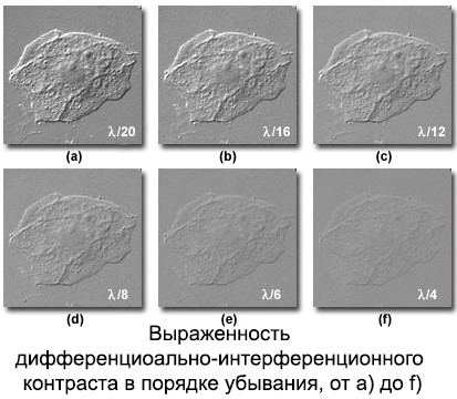 Дифференциально интерференционный контраст (ДИК) в биологии